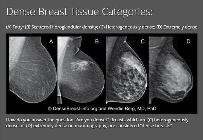 breast-density-guidelines